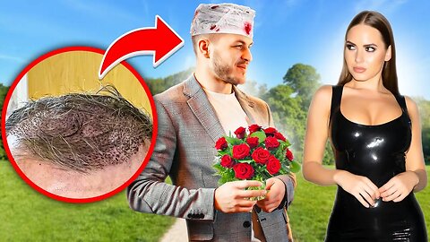 Guy With Bloody Head Flirts With Girl & Gets Her Number!