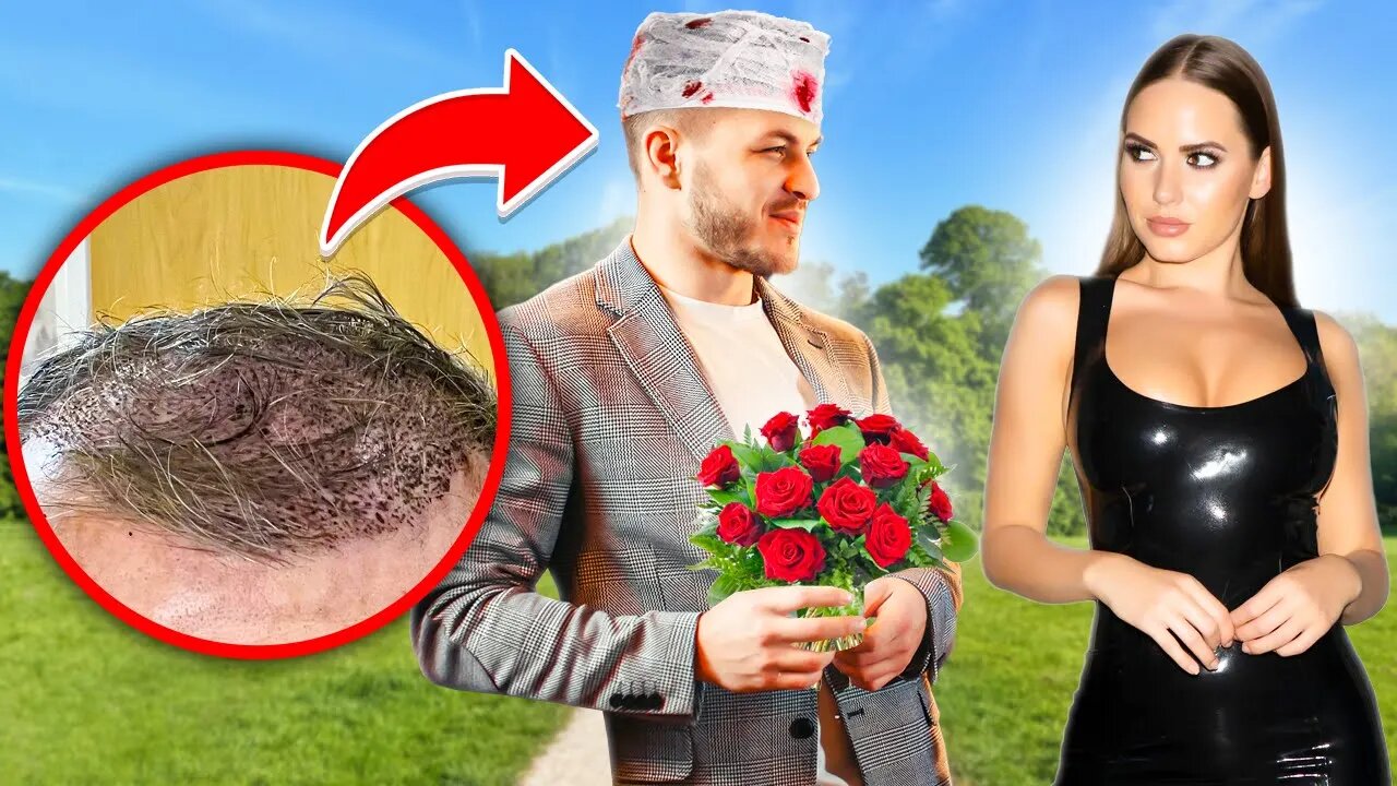 Guy With Bloody Head Flirts With Girl & Gets Her Number!