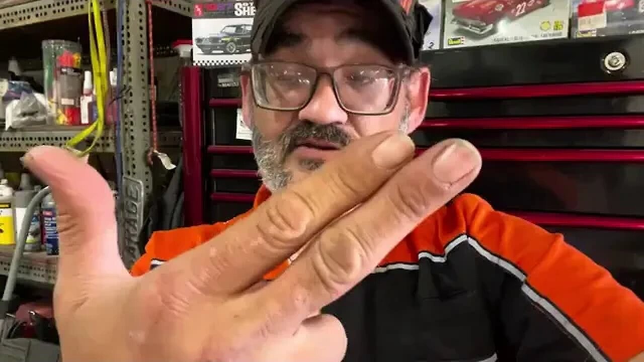 Colin Rogers ICU PT 25 Vid Of Colin Eye Opening ,Rally,Live My Thoughts