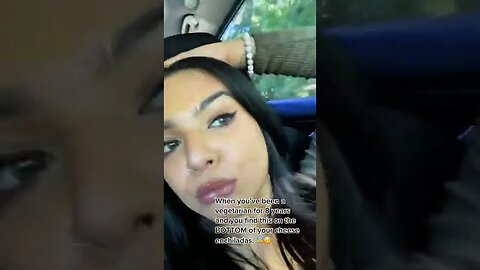 LITERAL shock Video By sumirb #Shorts