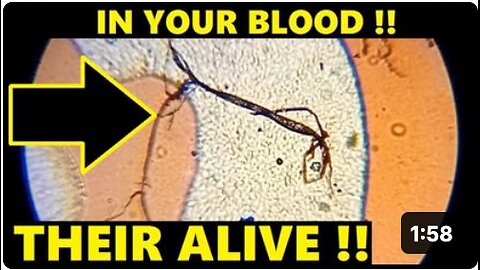 CREATURES GROWING IN UNVAXXED BLOOD !!