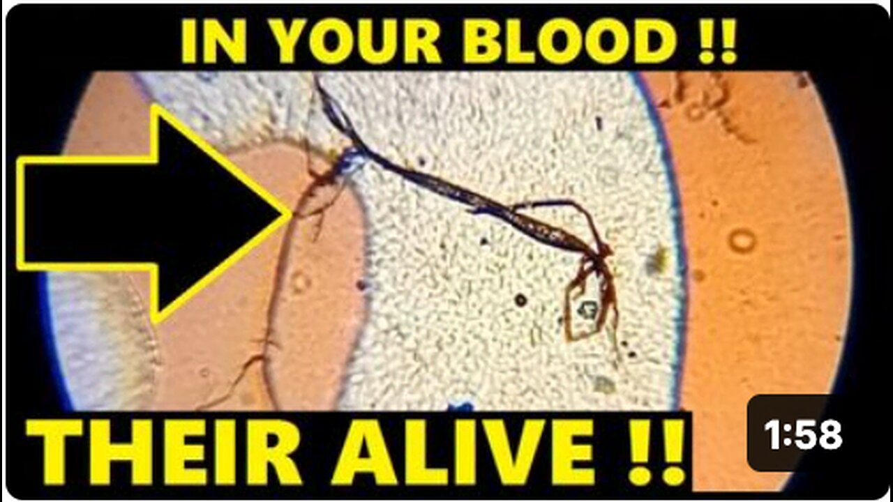 CREATURES GROWING IN UNVAXXED BLOOD !!