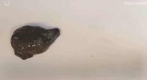 If you took the jab, this is what graphene oxide can do yo your body.