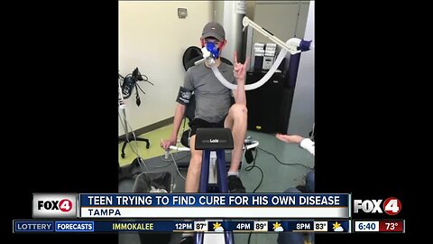 Teen trying to find cure for his own disease