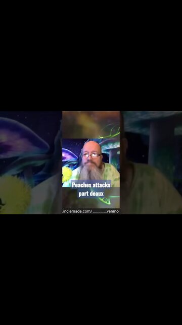 Peaches the cockatoo attacks stevers ear part 2