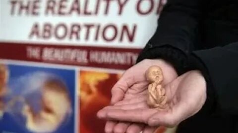 Abortion bots