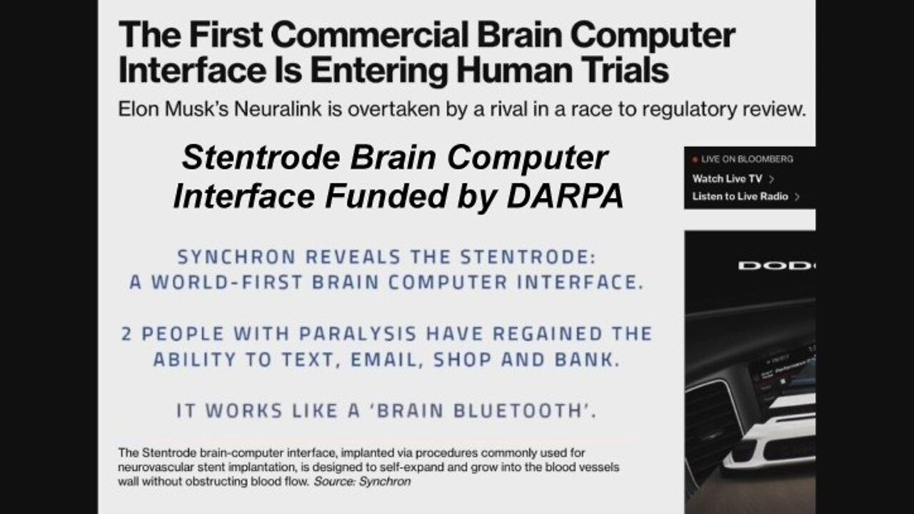 WARNING! This 'Stentrode Brain Computer' Will Be Game Over for All Humans! [07.05.2022]