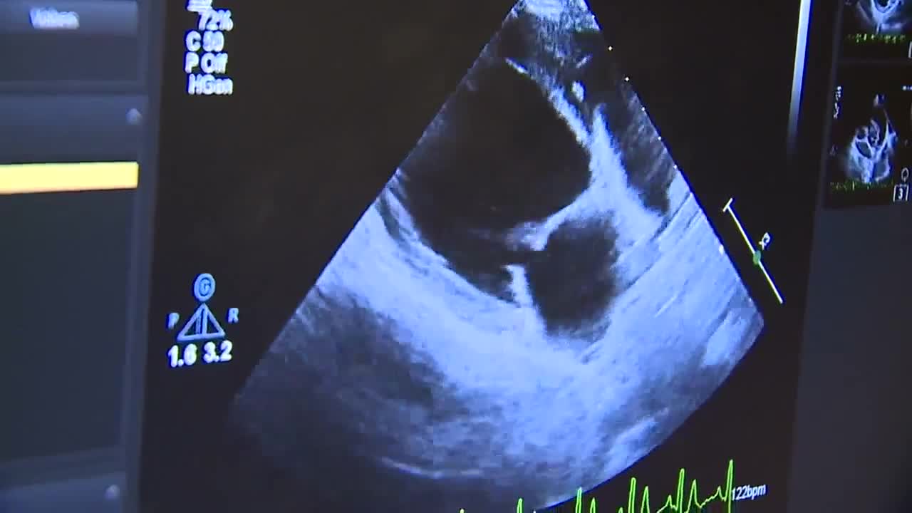 Dr. Heaney showing Lucy's case of DCM on echocardiogram