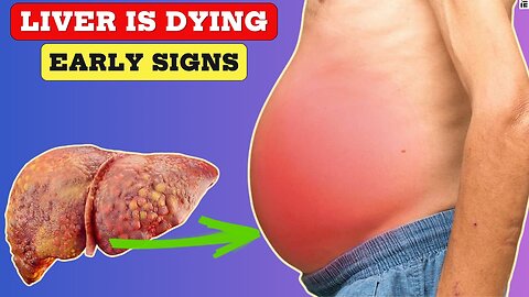 Early Warning Signs of Liver Damage