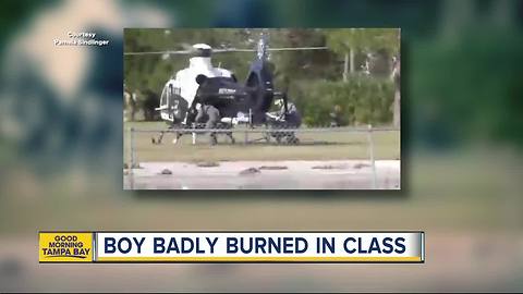 Clearwater student burned in school fire, airlifted to hospital