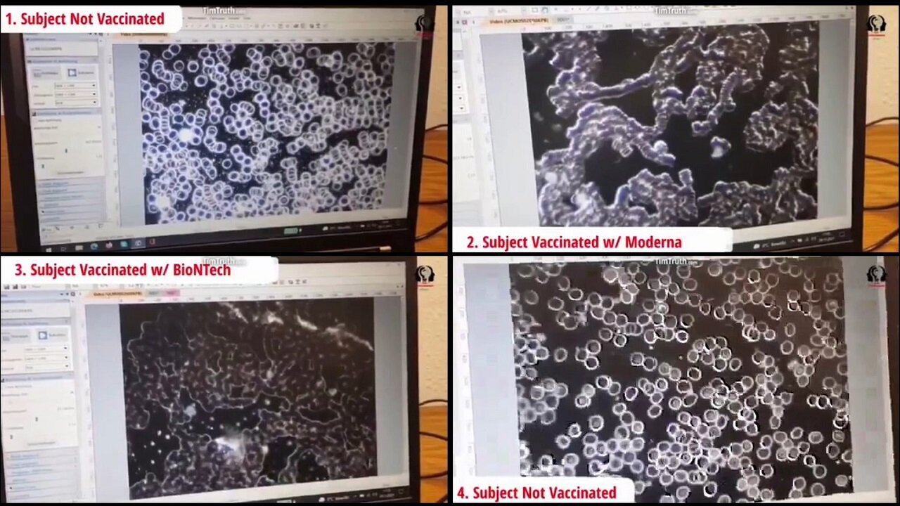 Vaccinated (with Covid 19 Vaccines) vs Unvaccinated Blood under the microscope