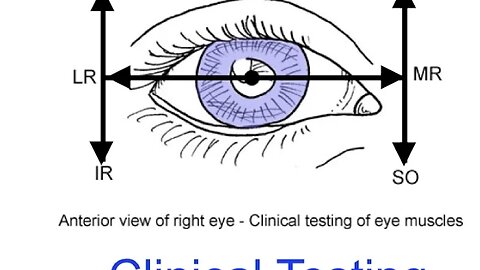 Clinical testing extraocular muscles tutorial