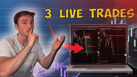 How To MANAGE RISK In Day Trading Live! (Nasdaq Futures Trading)