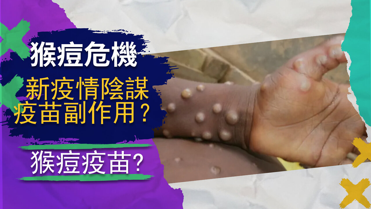 猴痘被列爲緊急狀態？ 需要擔心猴痘罵？ 猴痘背後的陰謀是什麼？