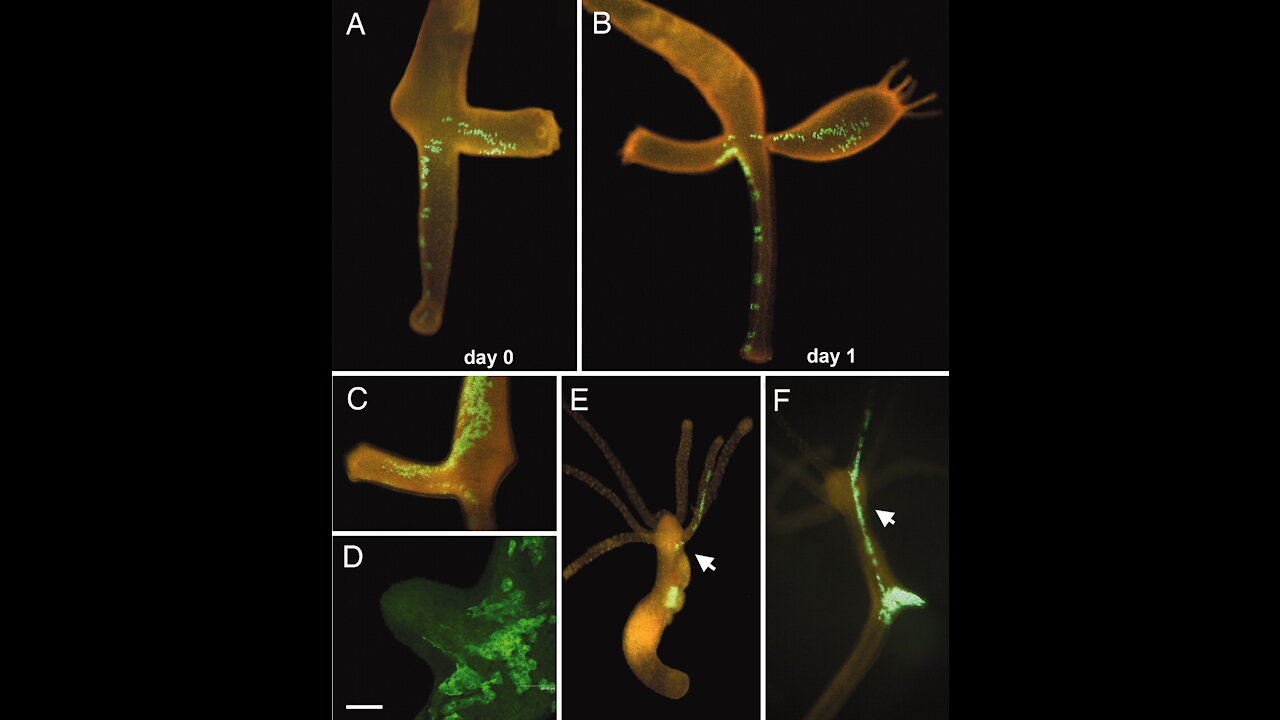 DR CARRIE MADEJ - TRANSGENE HYDRA EXPLAINED