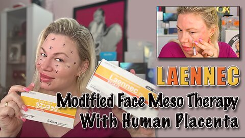 Modified Face Meso Technique with Laennec! AceCosm.com and code Jessica10 saves