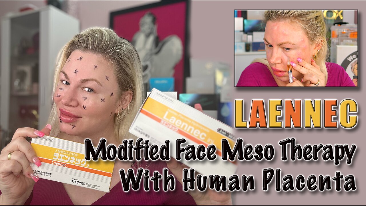 Modified Face Meso Technique with Laennec! AceCosm.com and code Jessica10 saves