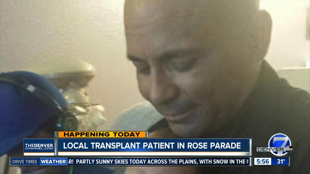 Local transplant patient will be in Rose Parade