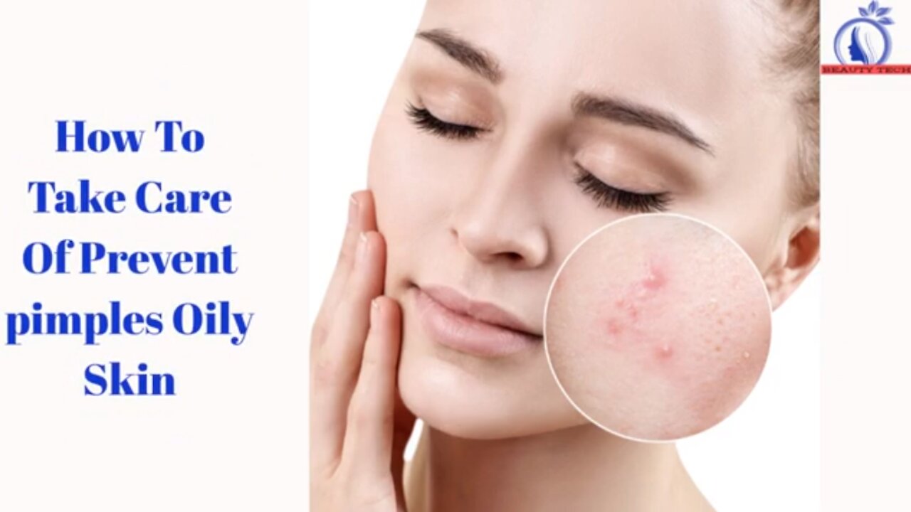 How to take care of Prevent pimples oily skin