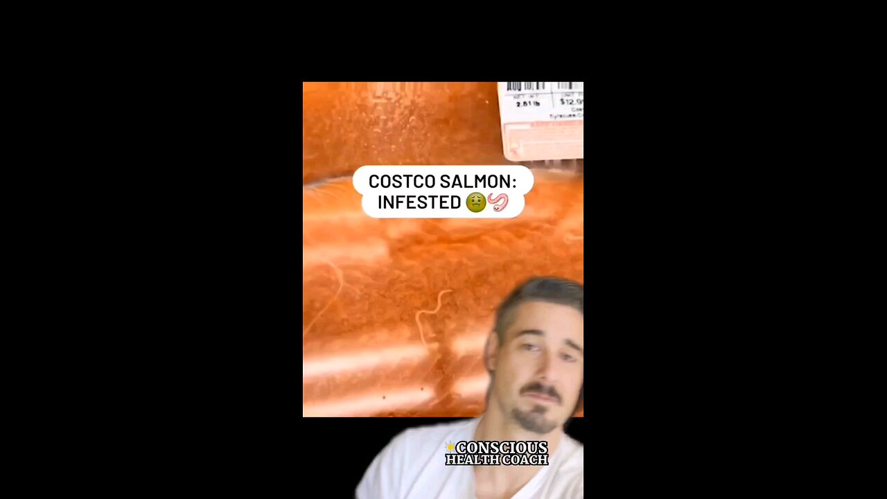 check out these parasites in this Costco salmon!!!