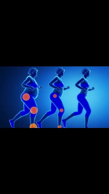 Why Obesity is Unhealthy Reason #1999 GRAVITY