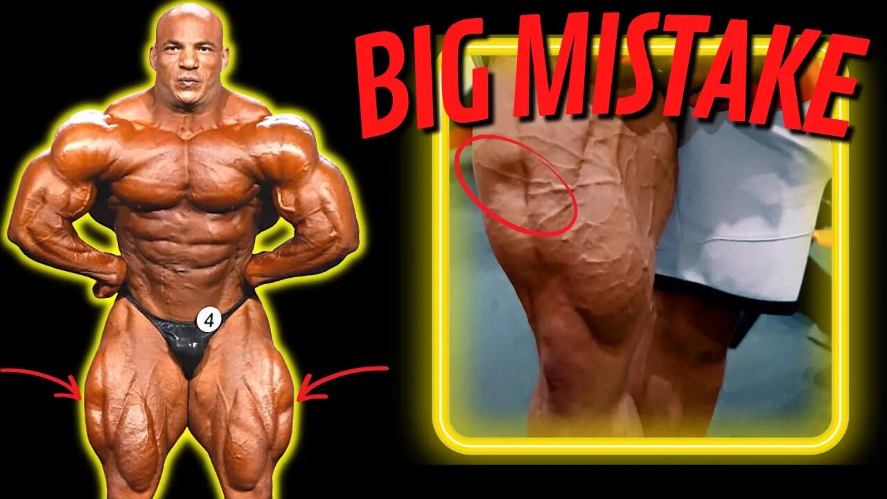 Proof! Big Ramy Has Injected Outer Sweeps