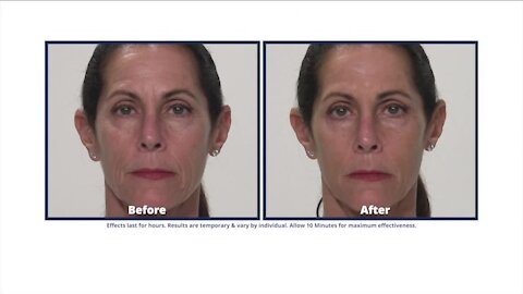 PLEXADERM DEAL FOR AM BUFFALO VIEWERS