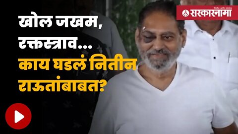 Bharat Jodo Yatra Update | माजी मंत्री नितीन राऊत यांचा धक्कादायक अनुभव | Maharashtra | Sarkarnama