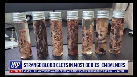 Embalmers across America are finding strange blood clots in most bodies