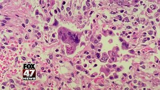 Measles quarantine issued at two California universities