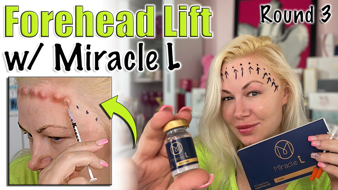 Forehead Lift with Miracle L from AceCosm.com, Round 3 | Code Jessica10 Saves you Money!