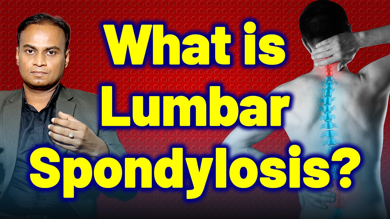 What is Lumbar Spondylosis? - Homeopathy Treatment & Cure | Dr. Bharadwaz | Homeopathy, Medicine