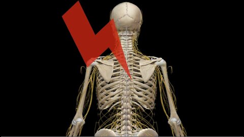 Heuschnupfen, Sinusitis, Tinnitus, HNO Probleme und die oberen Brustwirbel in der Osteopathie