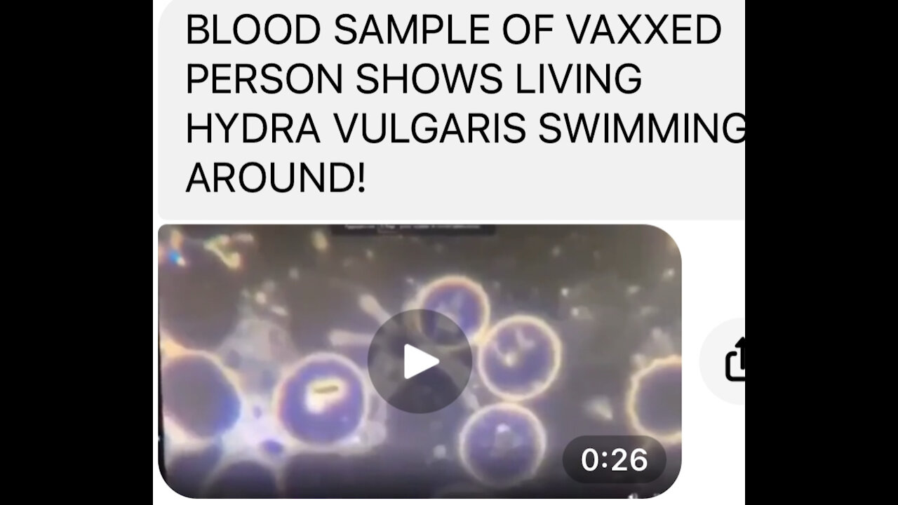 TSVN221 1.2022 Blood Sample Of Vaxxed Person Shows Living Hydra Vulgaris Swimming Around