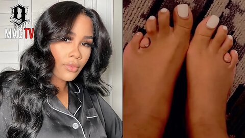 "I Don't Want It Fixed" Akbar V's Toes Are Just Different! 😱