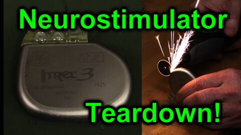 EEVblog #1027 - Implantable NeuroStimulator Teardown