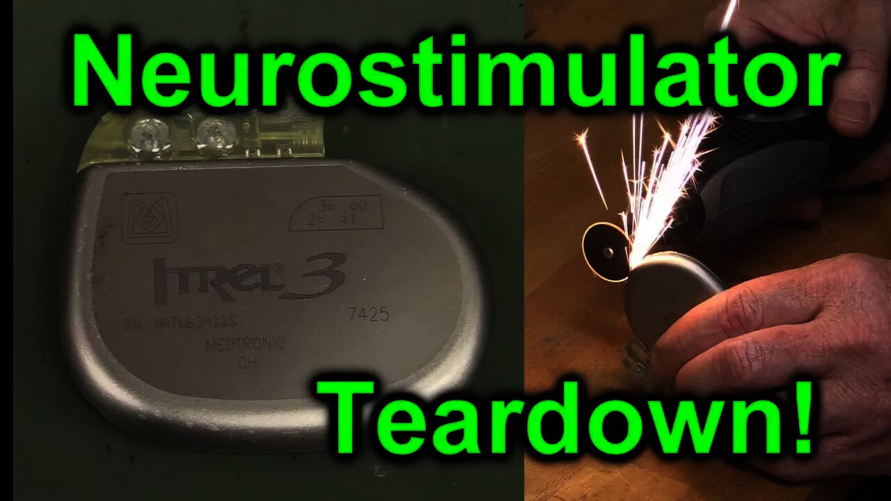 EEVblog #1027 - Implantable NeuroStimulator Teardown