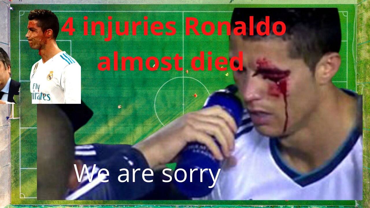 Top 4 Most dangerous injuries Ronaldo died almost