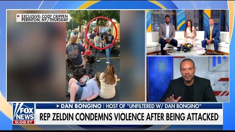 Bongino Calls Out The Left, Media After Rep Zeldin Attack