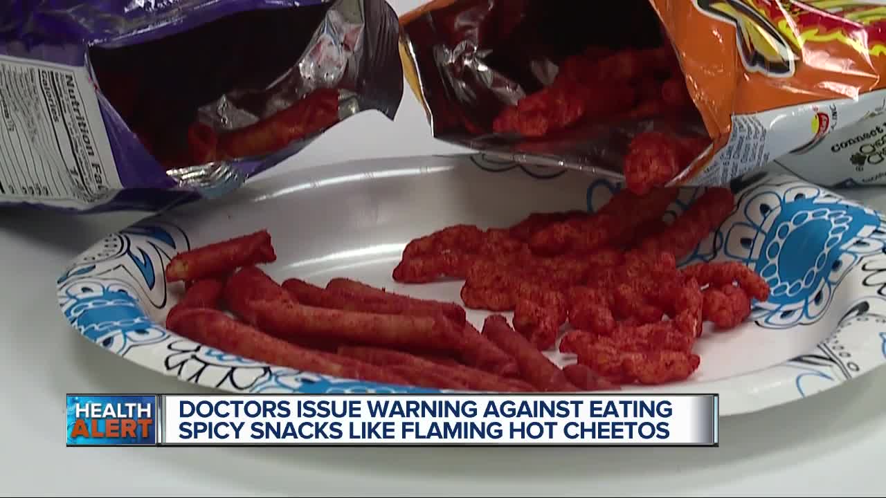 Hot Cheetos and Takis could land you in the emergency room