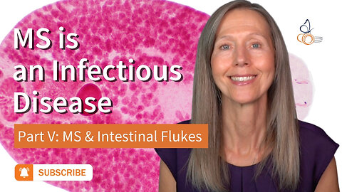 MS is an Infectious Disease Part : MS and Intestinal Flukes