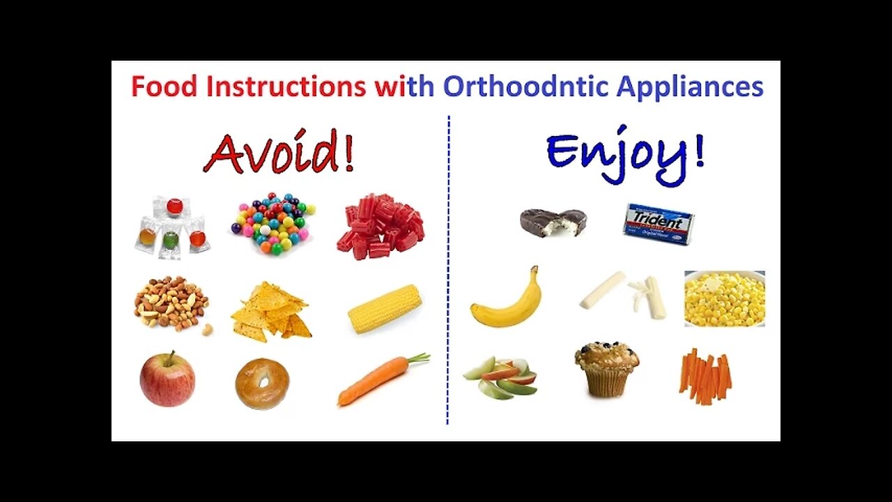 What Sort of Foods You Should not Eat, While Wearing Orthodontic Appliances, Braces by Dr Mike Mew