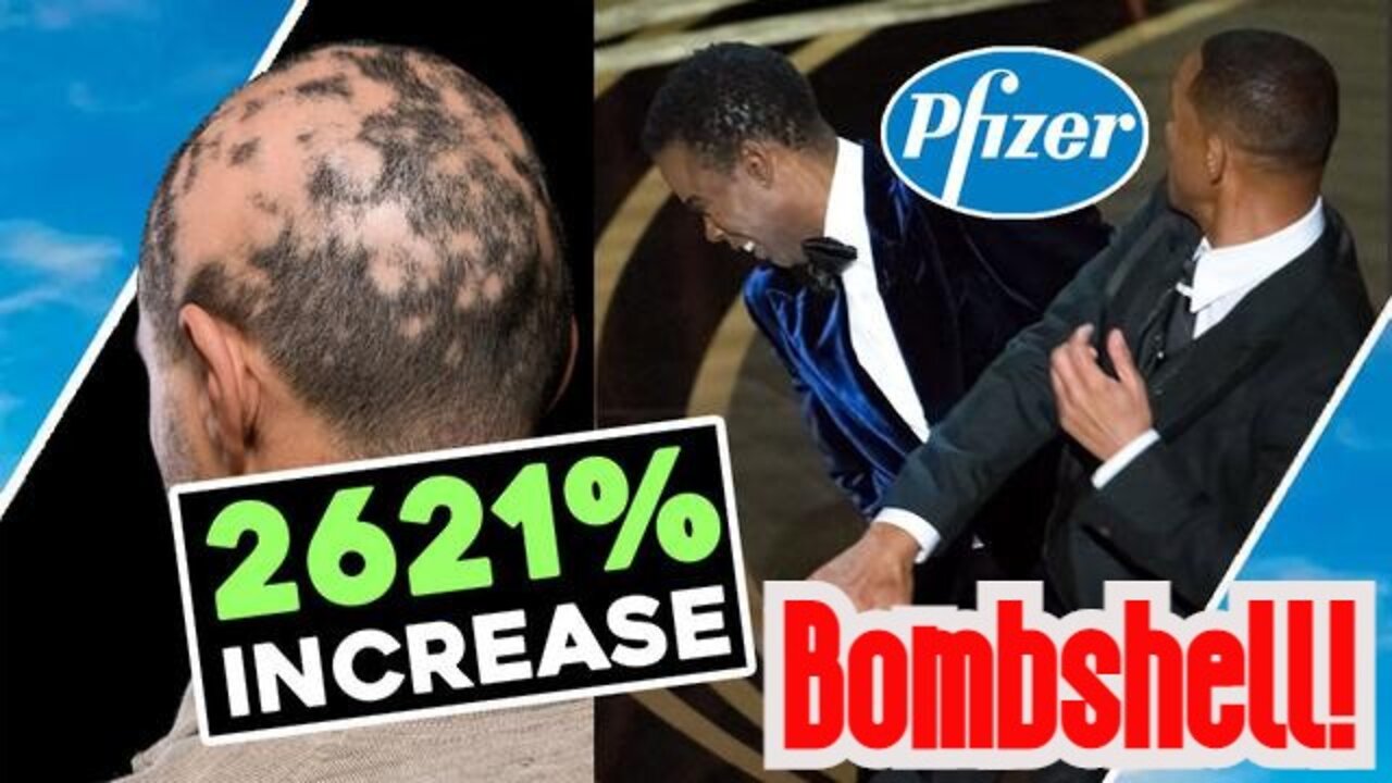 Bombshell: Pfizer SLAP Stunt HAIR LOSS 2621% ⬆ INCREASE