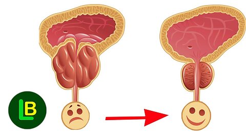 Keep Your Prostate Happy - Foods to Eat and Avoid