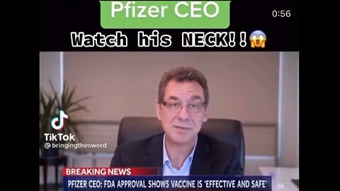 Can someone explain Albert Bourla's neck problems? [Pfizer CEO]