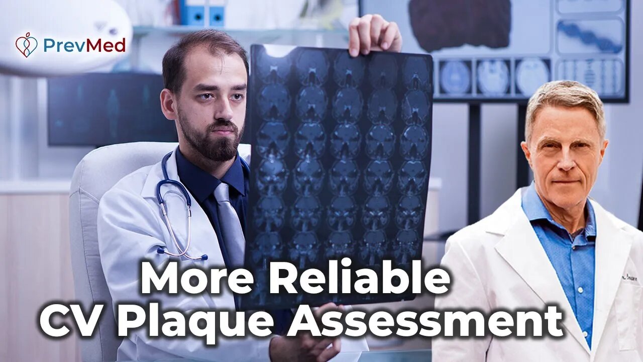 More Reliable CV Plaque Assessment