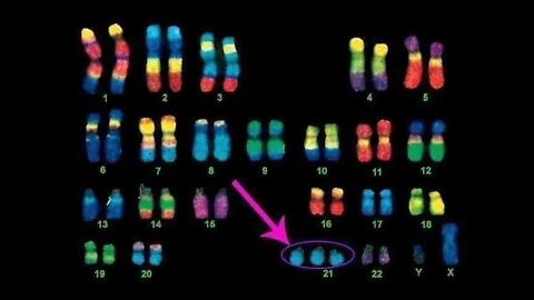 SPOILER ALERT: Wordle of the Day for 3/21/22 ... Happy World Down Syndrome Day!