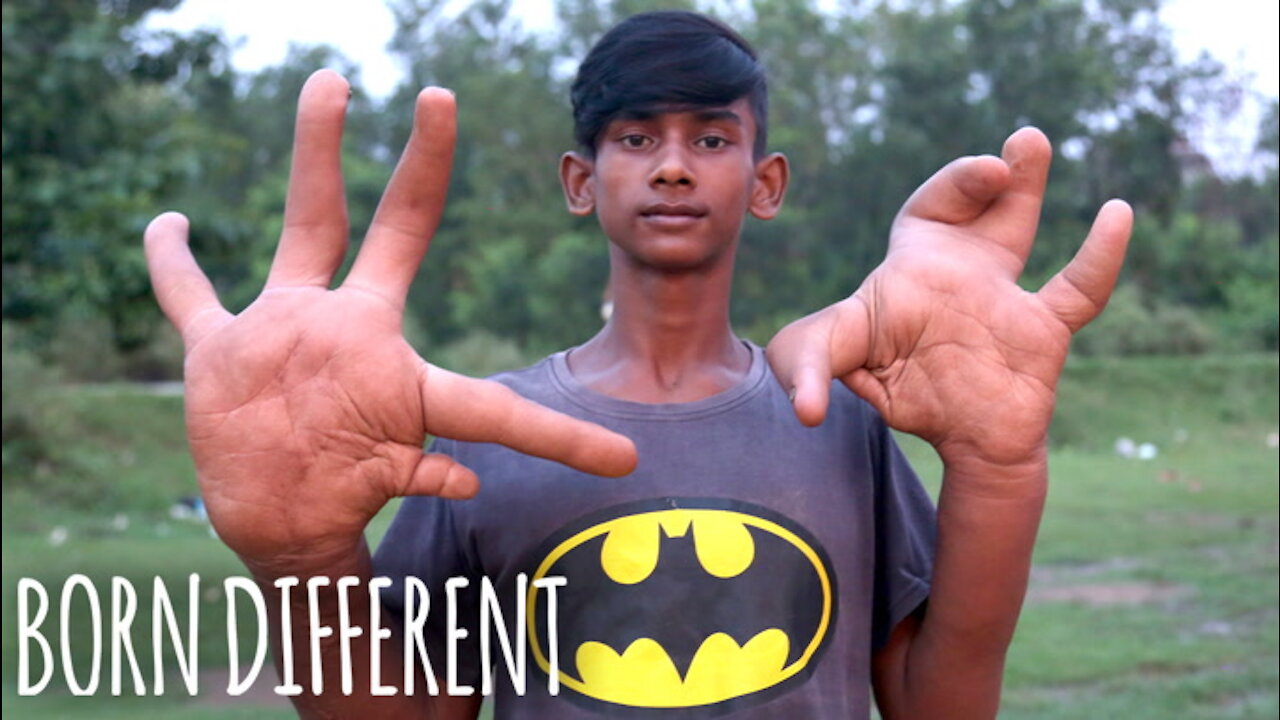 The Teen With The Giant Hands | BORN DIFFERENT