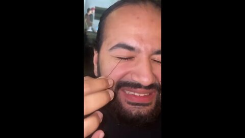 Ingrown hair removal weird satisfying 2022 tiktok