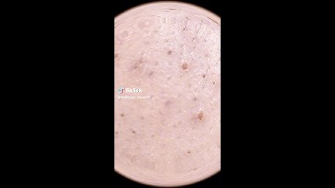 Blackhead extraction